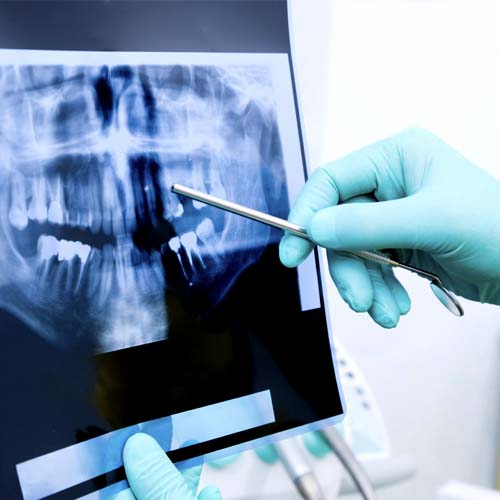 cirugía oral clínica dental ayora