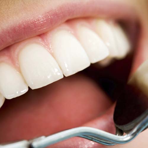 revisiones y limpieza oral clínica dental ayora